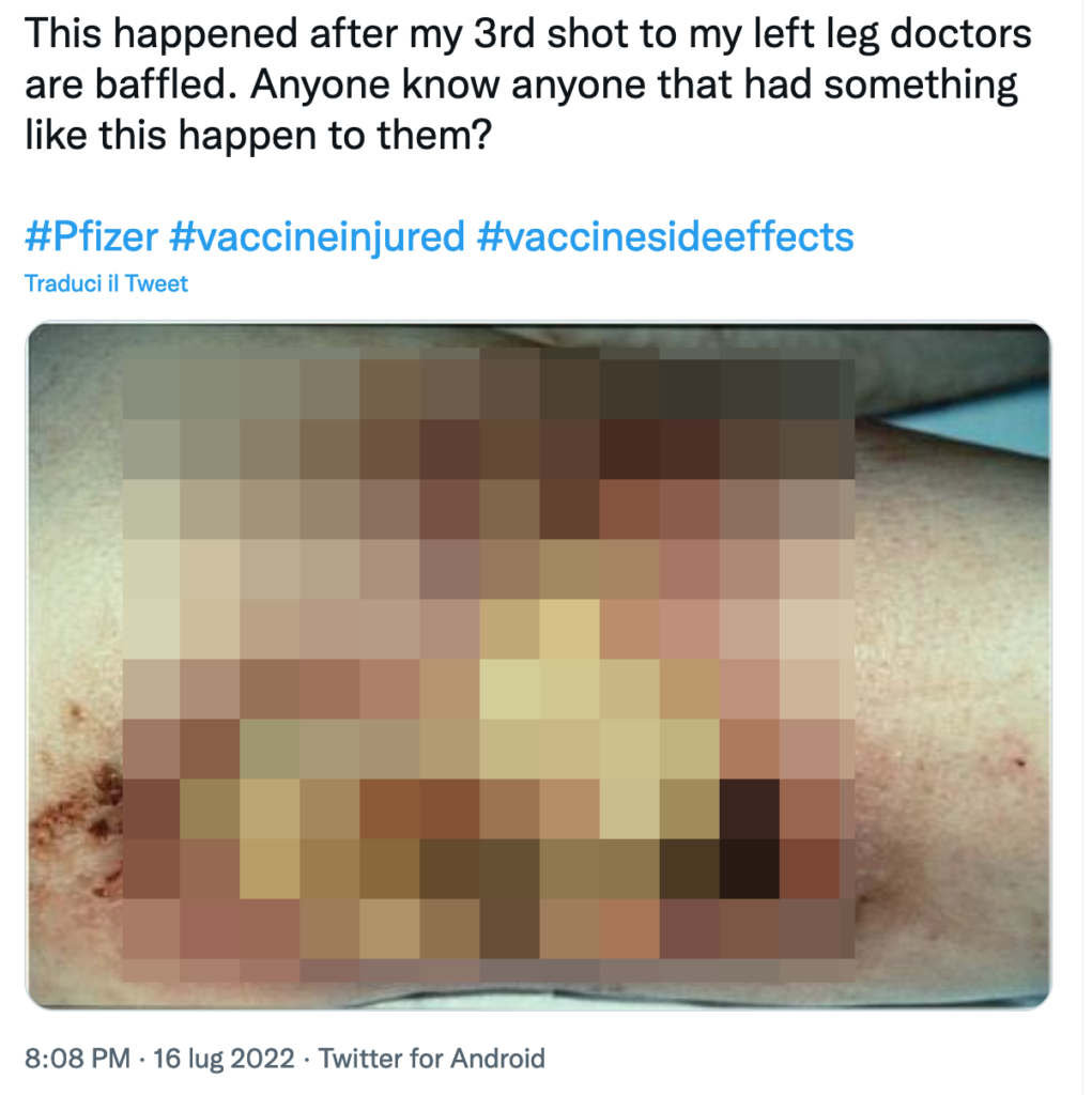 Accusa danni da terza dose, ma era una foto di Chernobyl