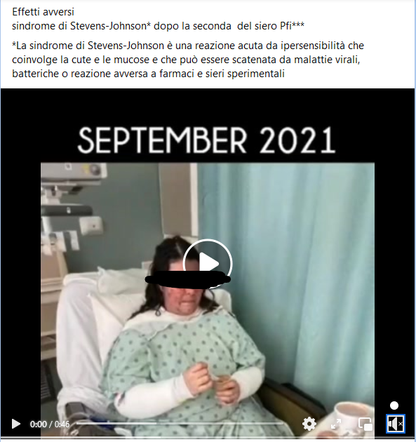 Usano video di una donna per inventare "effetti avversi alla pelle da siero"