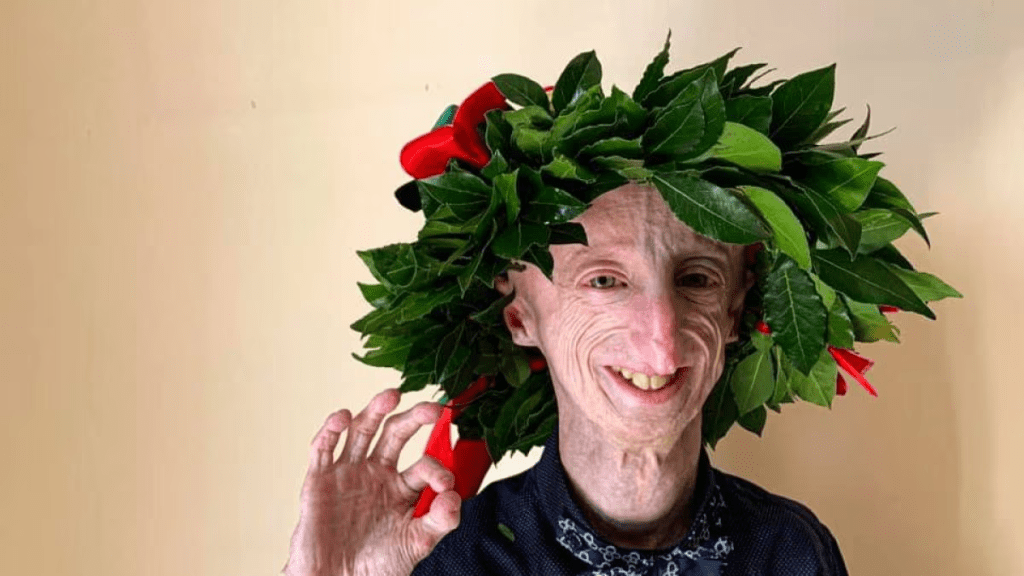 È morto a 28 anni il dottor Sammy Basso, divulgatore scientifico contro la progeria