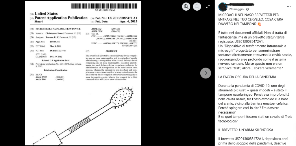 Tamponi con microaghi nel naso per manipolare il cervello? No, è una bufala che strumentalizza un brevetto